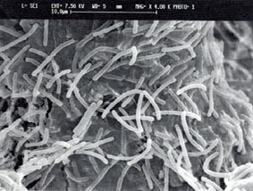 Mic_colonia-di-batteri-anaerobici-solfato-riduttori